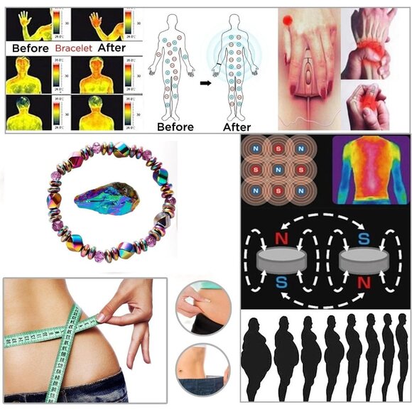 Multicolor Adjustable Hematite Bracelet - Stylish Relief for Arthritis & Anxiety - Picture 2 of 9